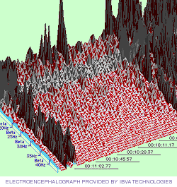 Electroencephalograph provided by IBVA Technologies